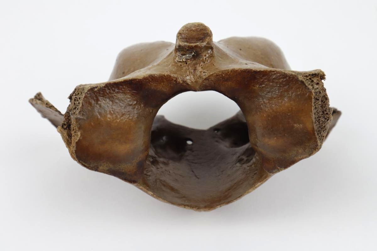 Atlas Vertebra of a Pleistocene Wild Horse (14,5 cm) - Image 3